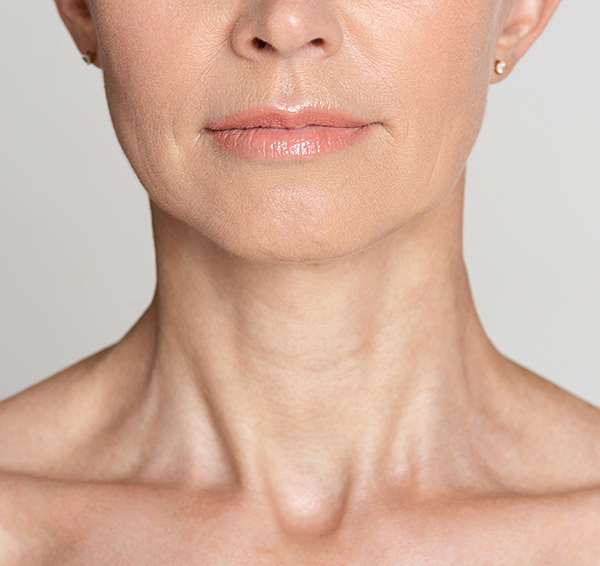 Close-up of a light skin toned mature woman's jawline, and neck.