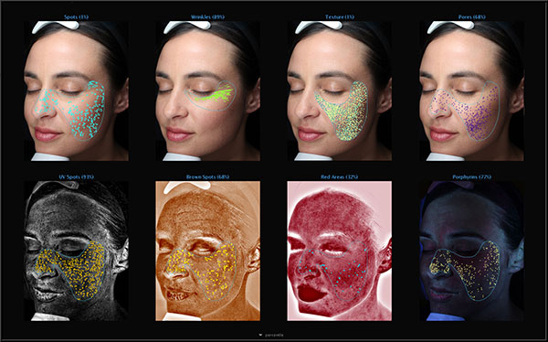 Series of Visia scans of a light skin toned woman