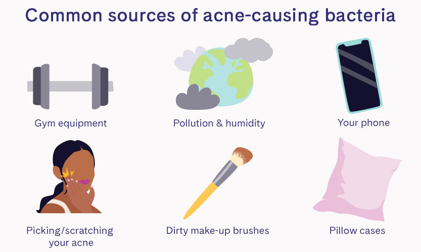 Common sources of acne-causing bacteria: Gym equipment, pollution and humidity, your phone, pickin gand scratching your acne, dirty makeup brushes, and pillow cases